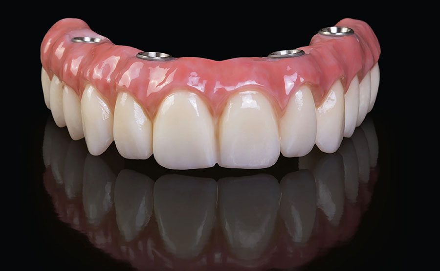 All On 4: Four Reasons To Explore More