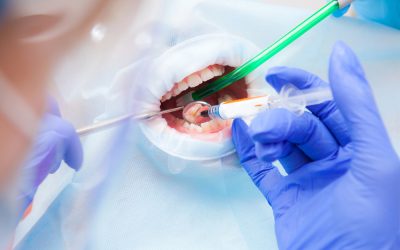 When Dental Treatment Goes Wrong: Understanding Dental Compensation Claims and Patient Rights in Australia